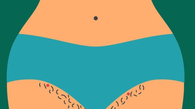 Kızlar, Bikini bölgemdeki batıklar nasıl geçer?