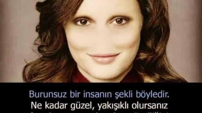 Burnunuzu başkalarının işine sokar mısınız?