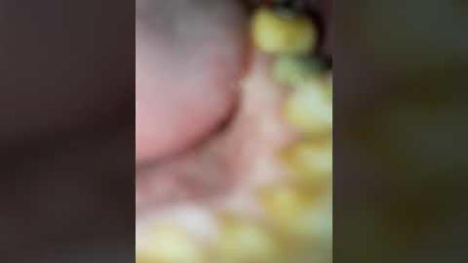 Diş etim ağrıyor videodaki gibi yapsammı?