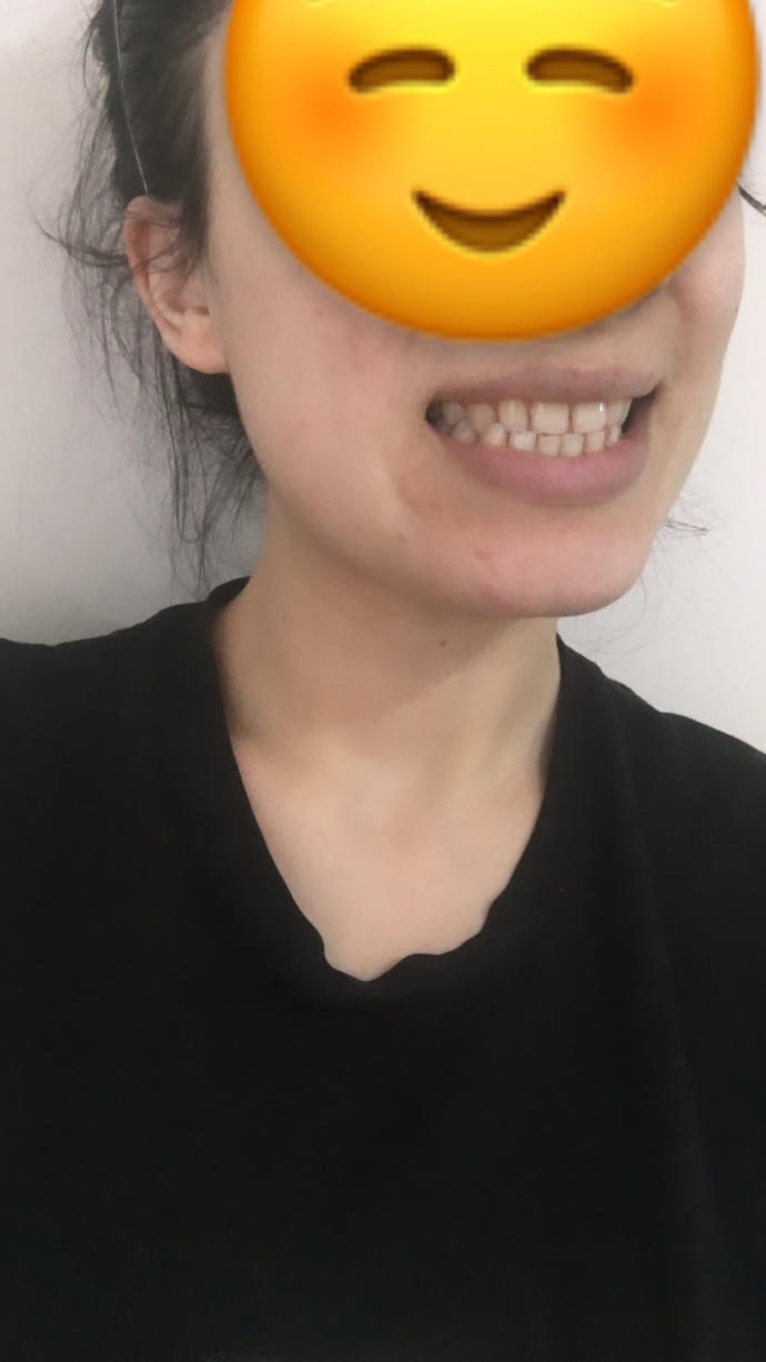Dişlerim çok kötü değil mi 😕?