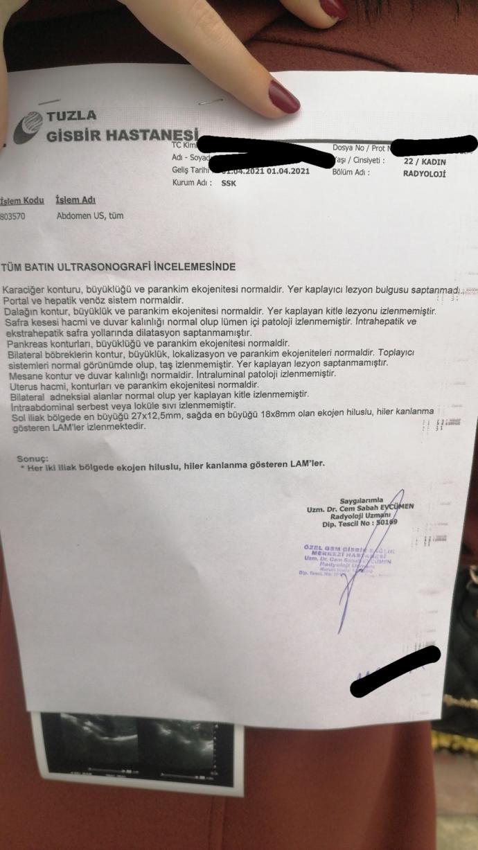 Ultrason raporumu yorumlayabilecek var mı?