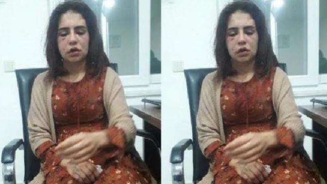 Sevgilisini öldüresiye döven şahıs savcılıktaki ifadesinin ardından serbest bırakıldı! Ne düşünüyorsunuz?