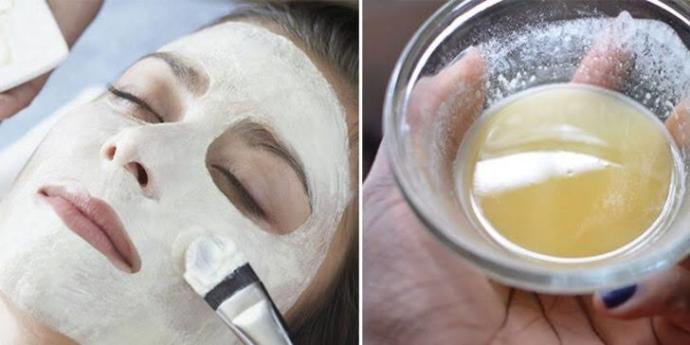 Karbonat ve limon sivilceye iyi gelir mi?