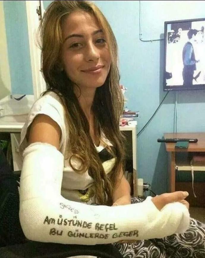 Alçıya ne yazılır?