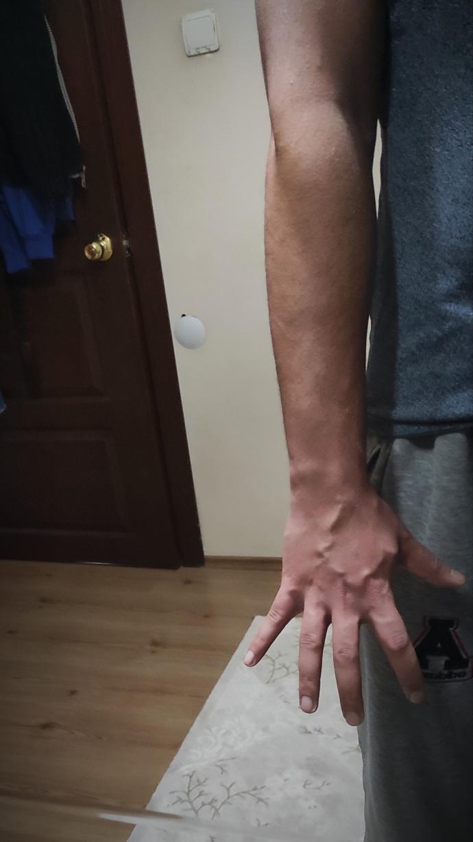 Sizinki de damarlı mı?