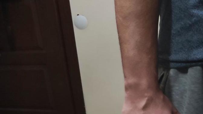 Sizinki de damarlı mı?