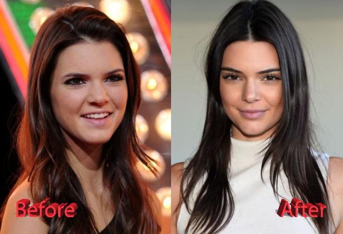 Kendall Jenner'ın bikinili pozları yürek yaktı! İdeal kadın vücudu budur diyebilir miyiz?