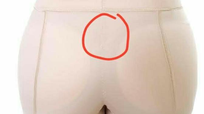 Popo çizgimin üstünde küçük bir çukur var bazı insanlarda olur mu bu?