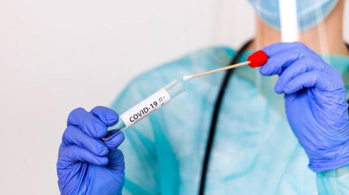 Covid testim pozitif çıktı ne yapmalıyım?