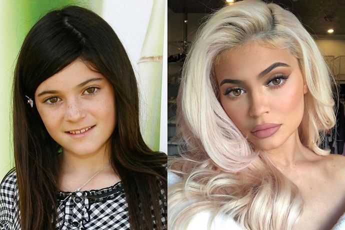 Estetikle Fahriye Evcen kadar güzel olabilir miyim ?