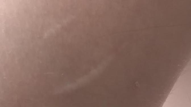 Jilet izi olduğu belli mi çok mu belli?