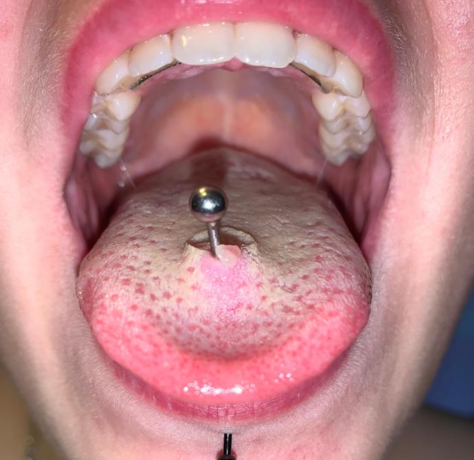 Dilime piercing taktırsam, sevgilim beni daha çekici bulur mu?