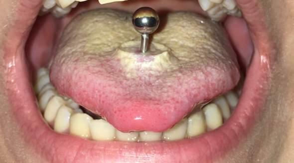 Dilime piercing taktırsam, sevgilim beni daha çekici bulur mu?