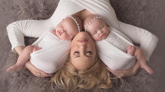 İkiz bebek bakımında nelere dikkat edilmeli?