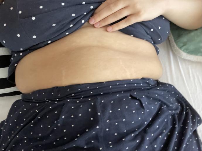 15 kilo daha verirsem göbeğim gider mi sizce?