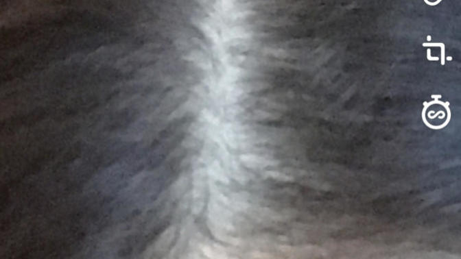 Bu saçta dökülme mi seyrekleşip, incelme mi olmuş?