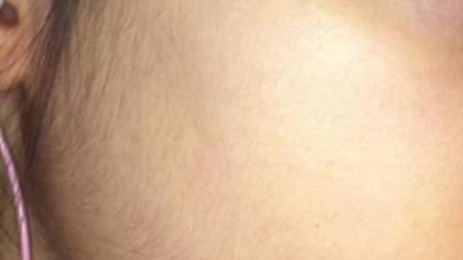 Usturayla yüz kıllarımı alsam kötü olur mu?
