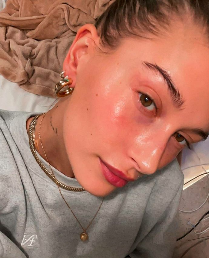 Hailey Baldwinin cildini beğeniyor musunuz?