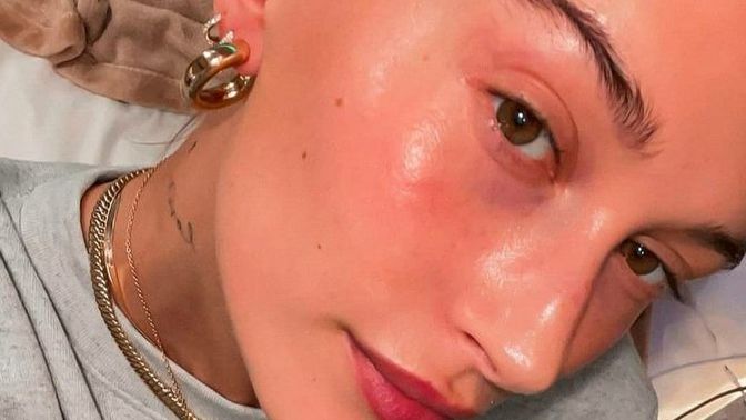 Hailey Baldwin'in cildini beğeniyor musunuz?