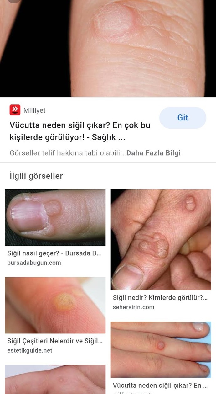 Son zamanlarda banyodan sonra hep aynı yerde fotoğraftaki şey çıkıyor. Sizce bu nedir?
