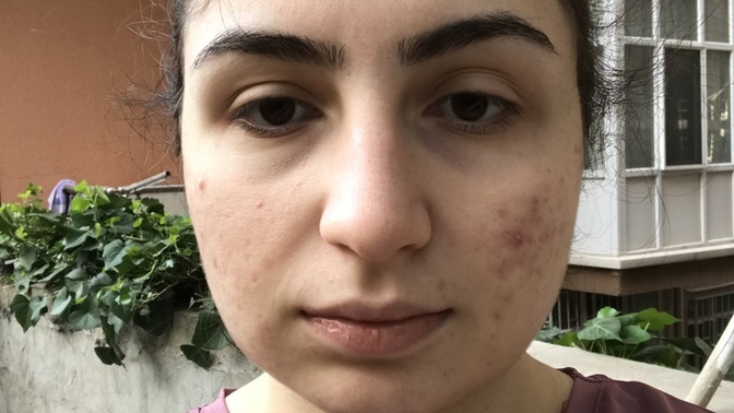 Ben niye bu kadar çirkinim, beni ne yapmak güzelleştirir? 