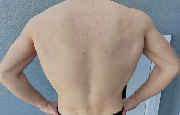 6 aydır spor yapıyorum, sırtım nasıl sizce?
