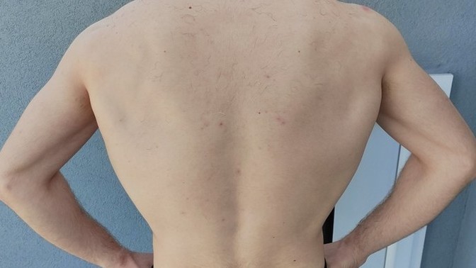6 aydır spor yapıyorum, sırtım nasıl sizce?