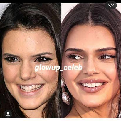 Sizce Kendall Jenner Sıradan Güzel Mi?