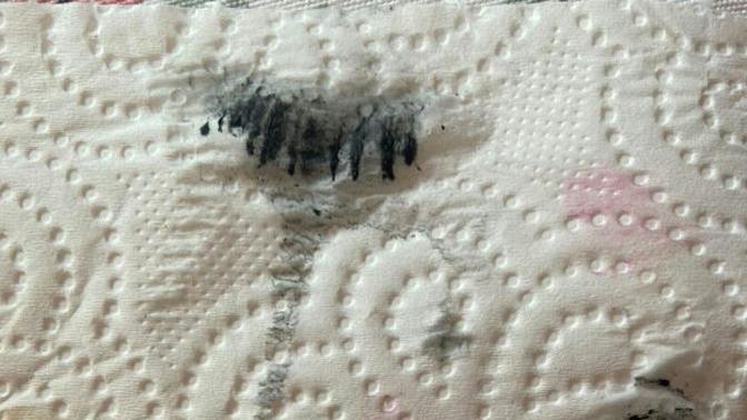 Sizce mutsuzluktan ölünür mü?