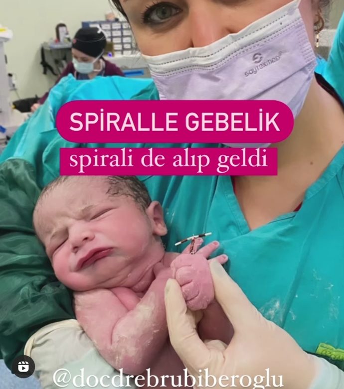 Spiral kullandığı halde, spirali kayıp hamile kalan  var mı?