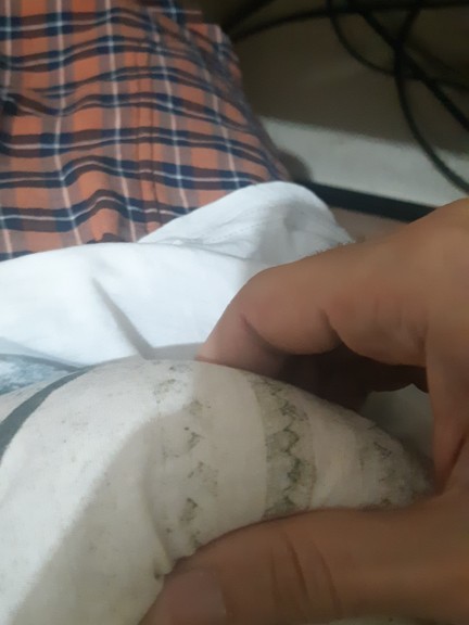 Hocam "spora ara ver" dedi. Sizce belim çok mu ince?