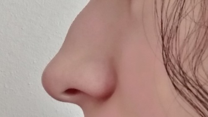 Burnum çok mu kötü?