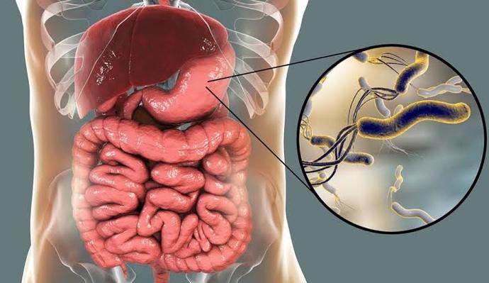 Dünya her 3 kişiden 1inde bulunan ve mide kanserine yol açan sinsi düşman helicobacter pylori nin semptomlarını biliyor musun ?