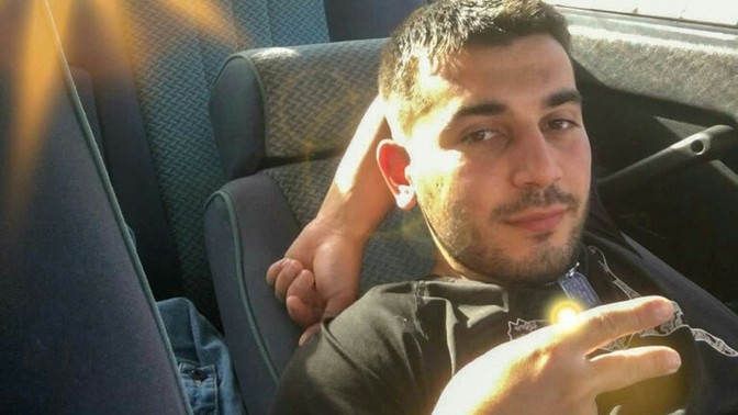 Göz kapağında ki düşme çok belli oluyor mu?