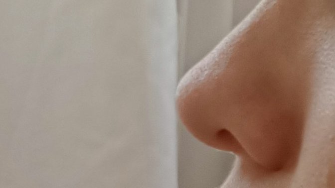 Burnuma estetik yaptırdım ama şimdi çok kötü durumda?