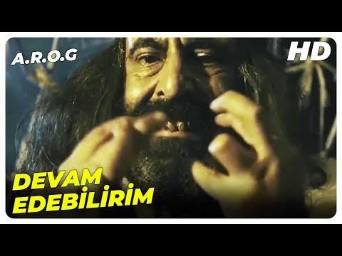 Parmaklarım eğik?