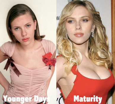 Scarlett johansson'ın memelerini küçültmesi hakkında ne düşünüyorsunuz?