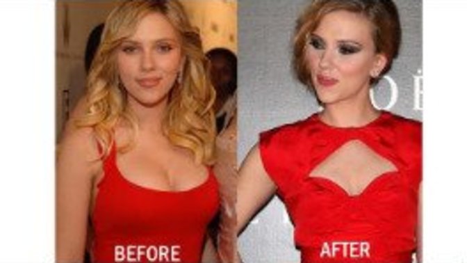Scarlett johansson'ın memelerini küçültmesi hakkında ne düşünüyorsunuz?