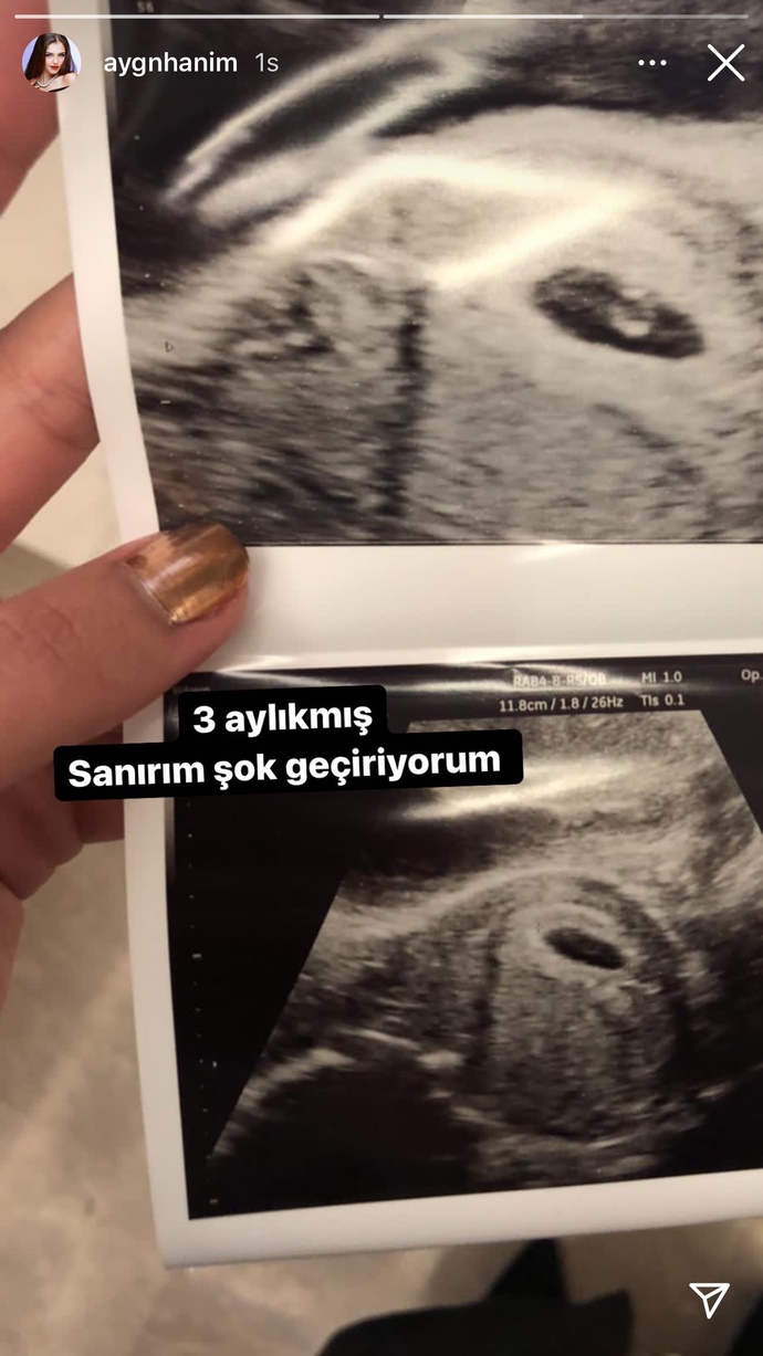 Hakan Sabancı baba oluyor. Aygün Aydın hamile mi?