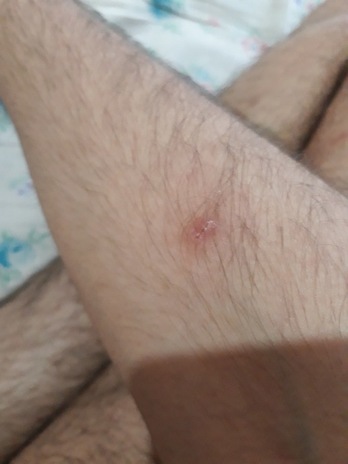 Bu illetin ne olduğunu bilen var mı?