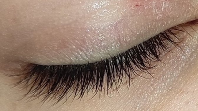 Gözümde çıkan şey ne (FOTOĞRAFLİ)?