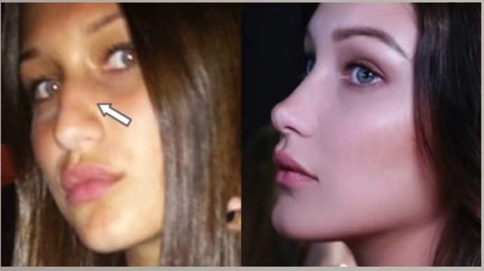 Eğer estetik icat edilmemiş olsaydı ünlüler bu kadar güzel olabilir miydi?