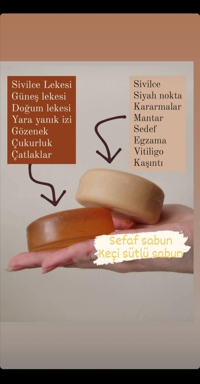 Kesinlikle bebek gibi yapıyor kullanmalısın 
