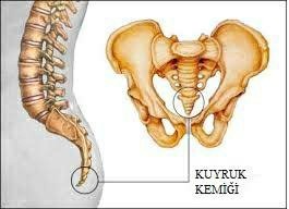 Tıbbın çare bulamadığı hastalık kuyruk sokumu ağrısıyaşayan var mı?