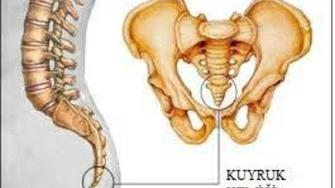 Tıbbın çare bulamadığı hastalık "kuyruk sokumu ağrısı"yaşayan var mı?