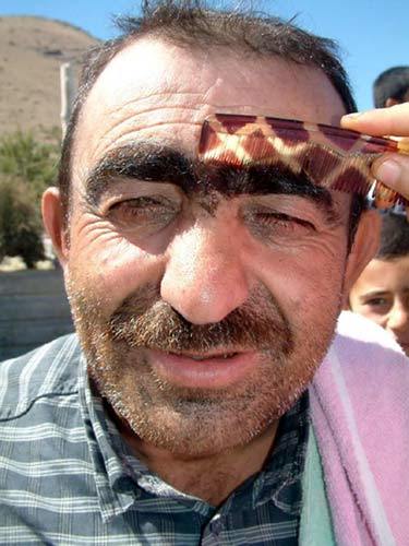 Kaş almak bakım mıdır?
