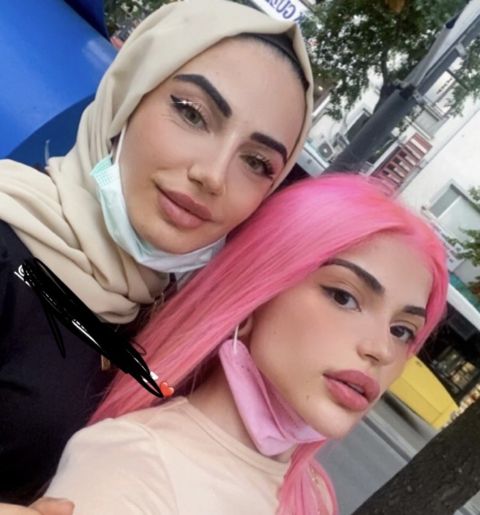 Arkadaşlar bu tiktok ünlüleri neden böyle full estetik hepsi yakışmış mı sizce allah aşkına bi bana mı abes geliyo?