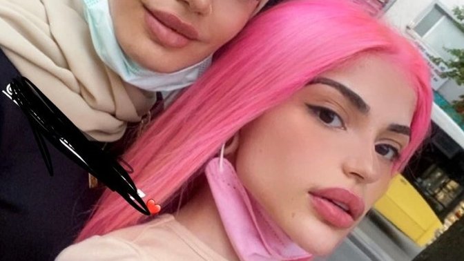 Arkadaşlar bu tiktok ünlüleri neden böyle full estetik hepsi yakışmış mı sizce allah aşkına bi bana mı abes geliyo?