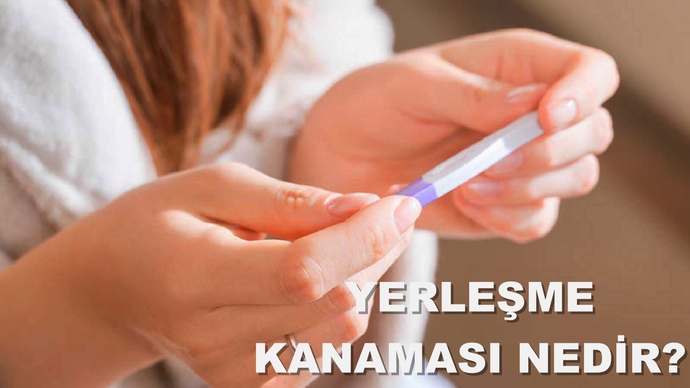 Yerleşme kanaması pıhtılı olmaz dimi?