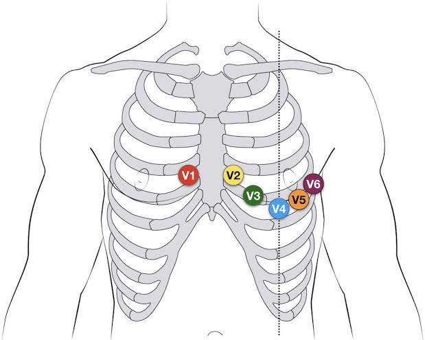 EKG nereye takılır?